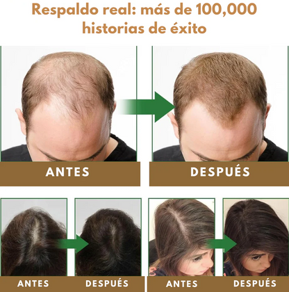 Anti-Hair Fall Shampoo - Anti-Caída y Reactivación Capilar
