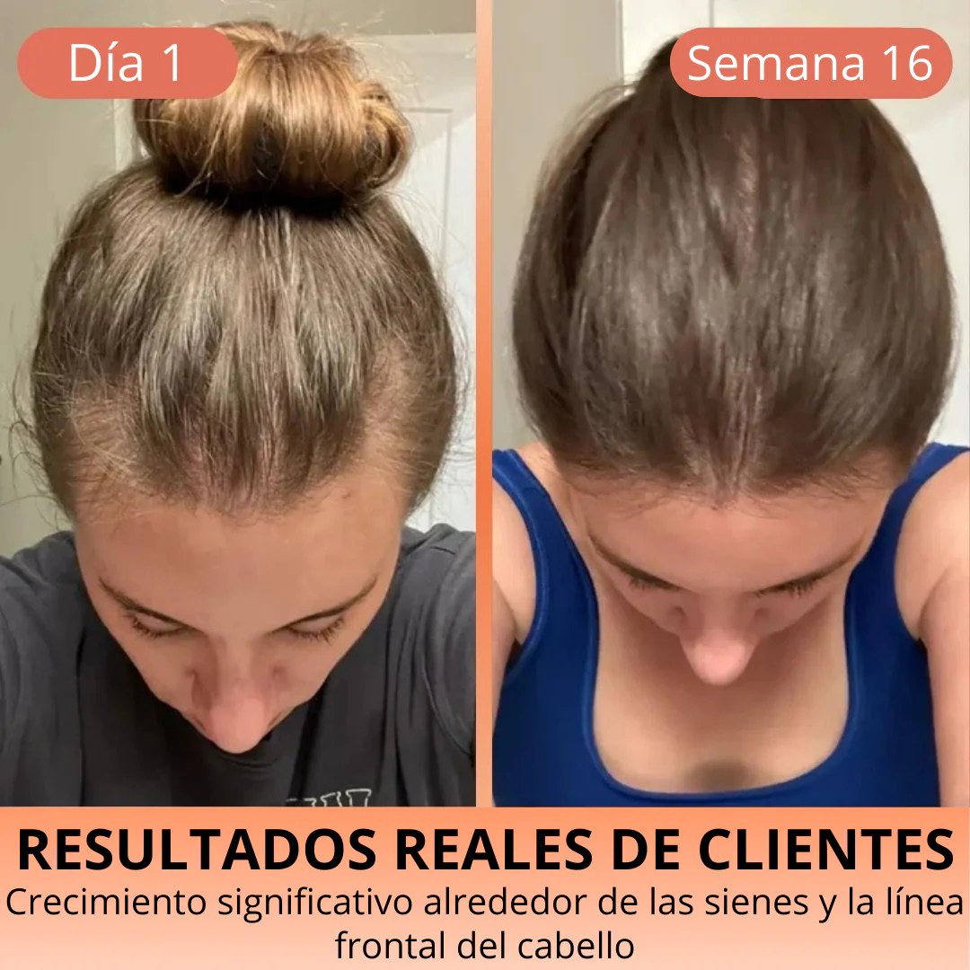 Aceite de Semilla de Calabaza 3000 mg – Cabello Fuerte y Piel Radiante