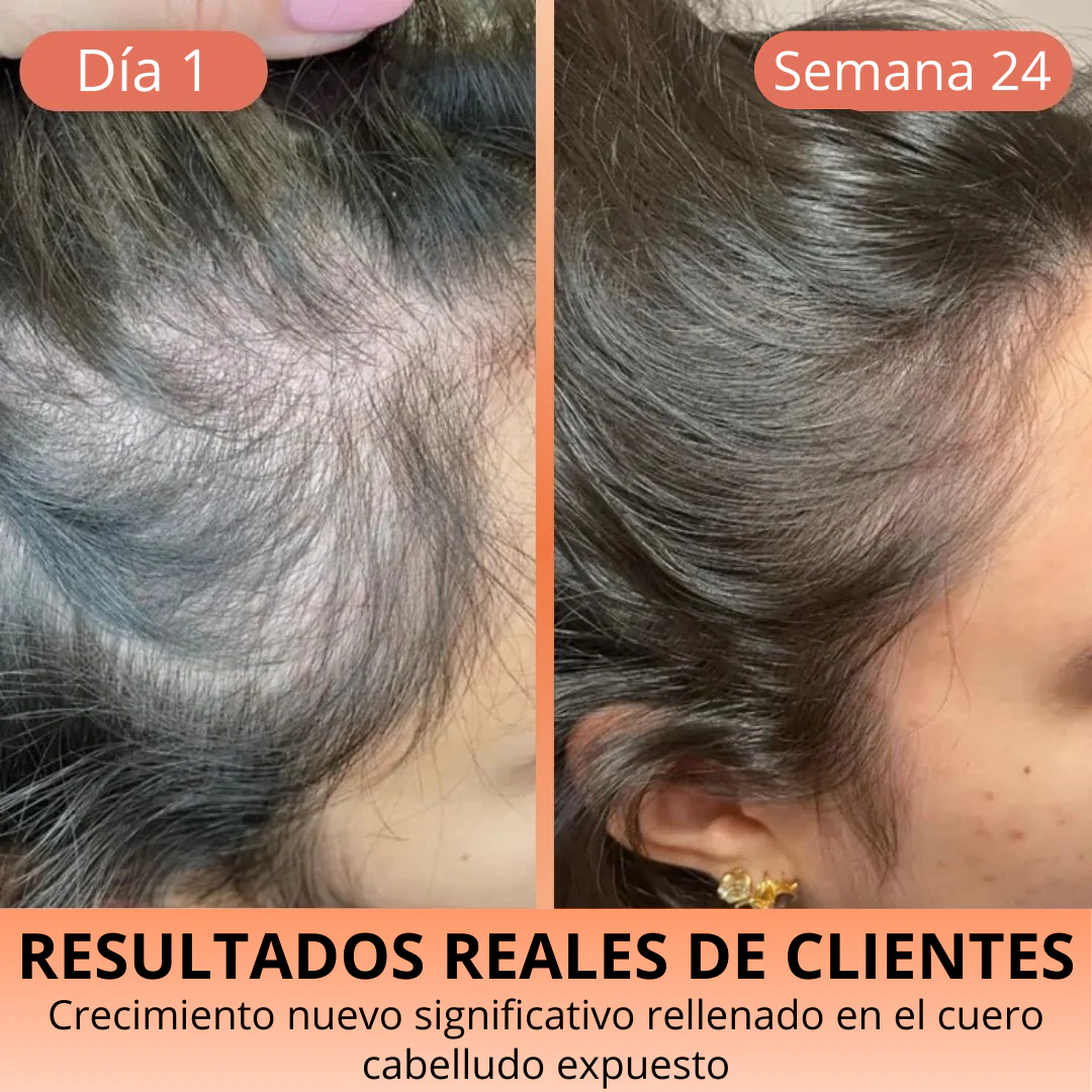 Aceite de Semilla de Calabaza 3000 mg – Cabello Fuerte y Piel Radiante