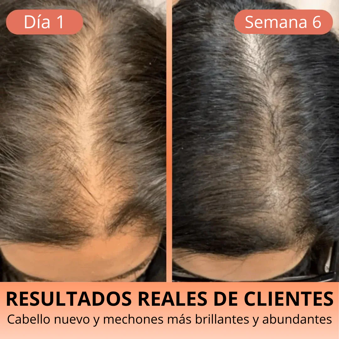 Aceite de Semilla de Calabaza 3000 mg – Cabello Fuerte y Piel Radiante